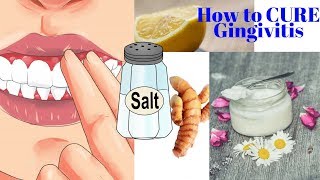 How to CURE Gingivitis With Turmeric Coconut Oil Baking Soda or LEMONS No dentist required [upl. by Schellens]