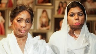 Acid Attack Survivors Beauty Salon Owner Helps Rehabilitate Victims [upl. by Cleodell547]