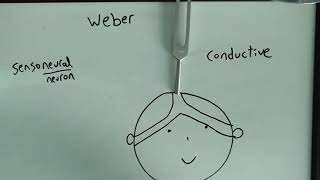 Weber Test made easy SensoneuralConductive hearing loss USMLE [upl. by Lekar59]