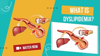 Dyslipidemia  What to know about dyslipidemia [upl. by Adnilreb55]