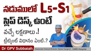 L5S1 disc prolapse symptoms diagnosis amp treatment  Health video  Dr GPV Subbaiah [upl. by Aehsan966]