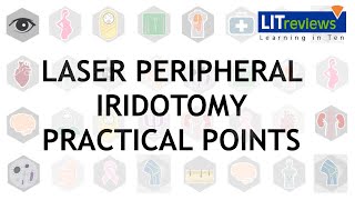 Laser Peripheral Iridotomy Practical Point [upl. by Atiugram]