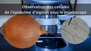 CELLULES DOIGNON AU MICROSCOPE [upl. by Easlehc794]