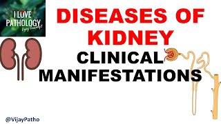 RENAL PATHOLOGY Part 1  Clinical Manifestations [upl. by Alysia]