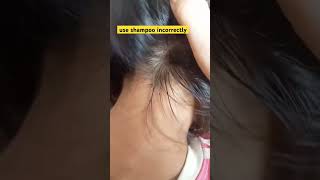 use shampoo incorrectly🧑‍⚕️👩‍⚕️👨‍⚕️😷shortvideo satisfying fishing siujuofficial [upl. by Ellenoj417]