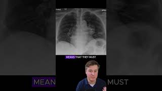 Hilum overlay sign  chest xray interpretation radiology medicalstudent radiologist [upl. by Dazhehs370]