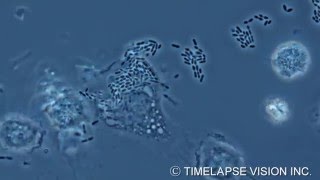 Bacterial phagocytosis by macrophage マクロファージによる細菌の貪食 [upl. by Bannerman508]