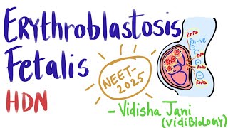 Erythroblastosis Fetalis HDN Rh Incompatibility NEET 2025Body Fluids and CirculationVidiBiology [upl. by Yrrum]