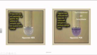 Group B Streptococci or Streptococcus Agalactia [upl. by Anwahsal695]