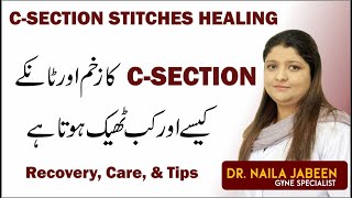 C Section Delivery Internal Stitches Wound Healing  Care Recovery amp Tips  Tanky Kesy Theek Kren Gy [upl. by Aaberg]