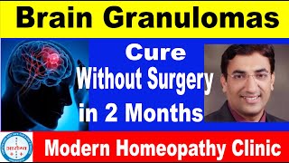 Brain Granulomas lesion  Treatment detail Dr Arpit Chopra Jain  Modern Homeopathy [upl. by Nonnarb]