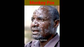 M pox Virus Monkey Pox New Virus shorts facts mpox [upl. by Mihcaoj]