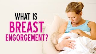 What is Breast Engorgement  DrPankaj Parekh  Dr Priti gangan  Lectsian Series  Child And You [upl. by Lashoh]