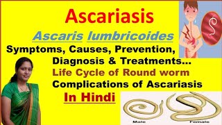 Ascariasis  Ascaris Lumbricoides  Symptoms Causes Diagnosis Treatment  Roundworm life cycle [upl. by Altis]