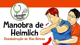 Manobra de Heimlich  Desobstrução de vias aéreas [upl. by Columba]