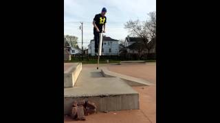 Pogo Stick Teeth Knock Out [upl. by Ahseyd]