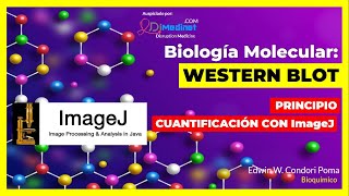 🟢 WESTERN BLOTT PARA DETECTAR PROTEÍNAS y UN SOFTWARE PARA CUANTIFICAR 🧪🔬🤓 [upl. by Inotna]