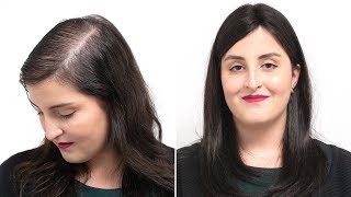 Solution for diffuse hair loss  Transformation with TriTec Hairsystem  Hairsystems Heydecke [upl. by Cymbre]