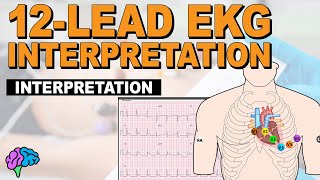 The SIMPLE Steps of 12Lead EKG Interpretation  EXPLAINED CLEARLY [upl. by Fricke]