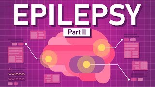 Causes of Epilepsy and How to Treat it [upl. by Ecirtel356]