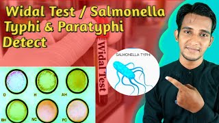 Widal Test Salmonella Typhi and Paratyphi Detect General knowledge for everyone [upl. by Kaasi956]