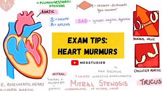 How to remember heart murmurs  Mnemonics Diagrams amp More  MedStudier [upl. by Main]