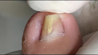 Folded nail Curve into double layer [upl. by Seline]