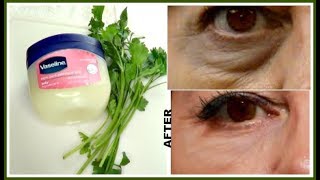 7 DAYS TO REMOVE DARK CIRCLES EYE BAGS  EYE WRINKLES AND LINES Khichi Beauty [upl. by Chee]