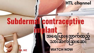 How to insert subdermal contraceptive implant drmz contraceptives familyplanning myanmar [upl. by Lever907]