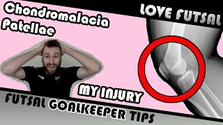 Injury update  Chondromalacia Patella  Runners Knee [upl. by Wivina38]