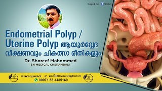 Endometrial Polyp Malayalam  Uterine Polyp Treatment Malayalam  Dr Shareef [upl. by Suilenrac]