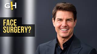 Tom Cruise’s Face Shock Is He Undergoing Surgery  Entertainment News [upl. by Enihpesoj]