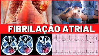 FIBRILAÇÃO ATRIAL  O QUE É  CAUSAS  TRATAMENTO  É GRAVE  TUDO QUE VOCÊ PRECISA SABER [upl. by Carrol]