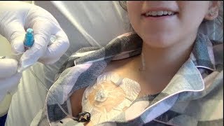 SURGERY VLOG PART FIVE Deaccessing my port for the first time and going home [upl. by Reiner]