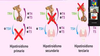 Video 6º Módulo ENDOCRINOLOGÍA Patología Tiroidea  Curso NOA 2024 [upl. by Casimir]