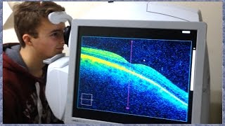 What is OCT Scanning Optical Coherence Tomography [upl. by Corrianne]