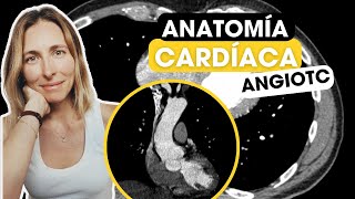 Todo lo que tienes que saber sobre anatomía cardíaca por TC✅ [upl. by Ioab]