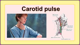 carotid pulse [upl. by Shandra]