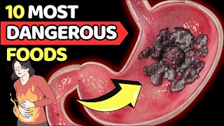 STOP IT Top 10 Most Dangerous Foods That People Keep Eating EVERY DAY Vitality Solutions [upl. by Nazus895]