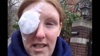 My Personal Story Surgery for ChalazionMeibomian Eye Cyst Removal 2023 [upl. by Berlyn]