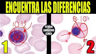 🩸Cómo Identificar Células Sanguíneas INMADURAS de la LÍNEA ROJAFases de EritropoyesisHematología🔬 [upl. by Manlove642]