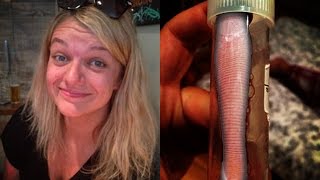 Woman Lets Leech Live in Her Nose for a WHOLE MONTH [upl. by Carina142]