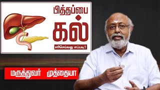 பித்தப்பை கல் சரி செய்வது எப்படி  How to fix gallstones Dr Muthaiah Latest Interview gallstone [upl. by Zulch]