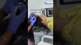 GFC Treatment  Hair loss Treatment  Maynee Cosmetology Clinic [upl. by Joaquin]