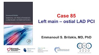 Case 85 PCI Manual  Ostial left mainLAD bifurcation stenting [upl. by Natlus]