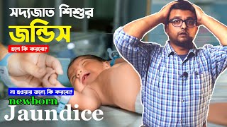 নবজাত শিশুর জন্ডিস  Newborn Jaundice  গুরুত্বপূর্ণ টিপস  Neonatal Jaundice  How to stop [upl. by Rosol]