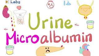 Microalbumin in the Urine Microalbuminuria  Diabetes Mellitus amp Kidney Disease  Nephrology Labs [upl. by Suollecram658]