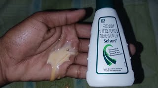 Selsun Shampoo Honest Review [upl. by Raf]