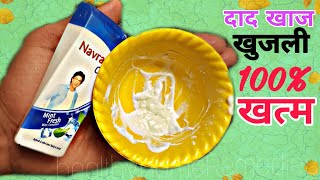 दाद खाज खुजली कितना भी पुराना हो यह लगा लो एक दिन में छुट्टी कर देगा Fast fungal ringworm treatment [upl. by Stochmal387]