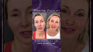 Ponytail Facelift Plastic Surgery Results Part 6 At Kao Plastic Surgery facelift beforeandafter [upl. by Stark]